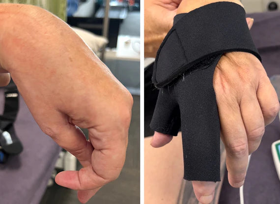 ABD Neoprene Hand Based Orthosis
